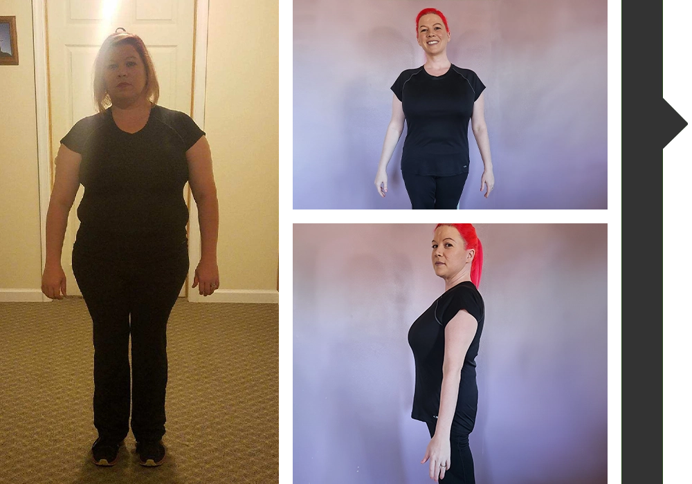 Weight Loss Edgewood MD Before And After Collage